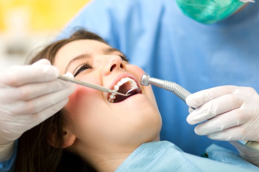 Dental Filling in Fort Lauderdale